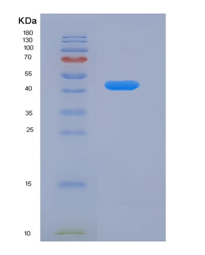 SDS-PAGE analysis of Human SERPINF1 (Pigment Epithelium-Derived Factor) - Recombinant Protein, CAT# BLT-02208P, showing >95% purity under 15% SDS-PAGE (Reduced)Human SERPINF1 (Pigment Epithelium-Derived Factor) - Recombinant Protein