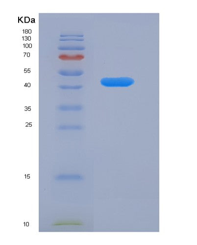 SDS-PAGE analysis of Human SERPINF1 (Pigment Epithelium-Derived Factor) - Recombinant Protein, CATHuman SERPINF1 (Pigment Epithelium-Derived Factor) - Recombinant Protein
