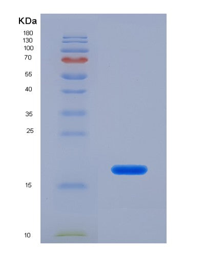 SDS-PAGE analysis of Human FDFT1 (Squalene Synthase) - Recombinant Protein, CATHuman FDFT1 (Squalene Synthase) - Recombinant Protein