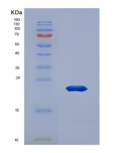SDS-PAGE analysis of Human ANP32A (Acidic Leucine-Rich Nuclear Phosphoprotein 32 Family Member A) - Recombinant Protein, CAT# BLT-00165P, showing >85% purity under 15% SDS-PAGE (Reduced)Human ANP32A (Acidic Leucine-Rich Nuclear Phosphoprotein 32 Family Member A) - Recombinant Protein
