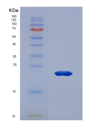 SDS-PAGE analysis of Human ANP32A (Acidic Leucine-Rich Nuclear Phosphoprotein 32 Family Member A) - Recombinant Protein, CATHuman ANP32A (Acidic Leucine-Rich Nuclear Phosphoprotein 32 Family Member A) - Recombinant Protein