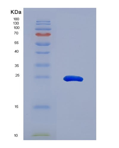 SDS-PAGE analysis of Human STAT3 (Signal Transducer And Activator Of Transcription 3) - Recombinant Protein, CAT# BLT-04956P, showing >95% purity under 15% SDS-PAGE (Reduced)Human STAT3 (Signal Transducer And Activator Of Transcription 3) - Recombinant Protein