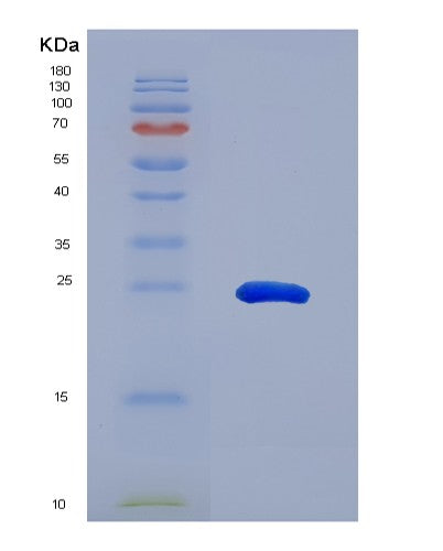 SDS-PAGE analysis of Human STAT3 (Signal Transducer And Activator Of Transcription 3) - Recombinant Protein, CATHuman STAT3 (Signal Transducer And Activator Of Transcription 3) - Recombinant Protein