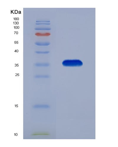 SDS-PAGE analysis of Human MDH2 (Malate Dehydrogenase, Mitochondrial) - Recombinant Protein, CAT# BLT-01819P, showing >90% purity under 15% SDS-PAGE (Reduced)Human MDH2 (Malate Dehydrogenase, Mitochondrial) - Recombinant Protein