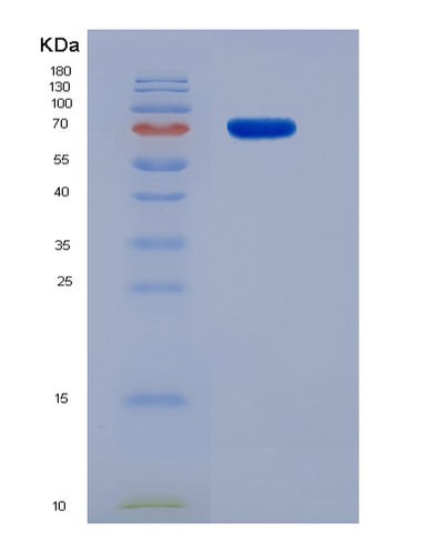 SDS-PAGE analysis of Mouse Dpp9 (Dipeptidyl Peptidase 9) - Recombinant Protein, CAT# BLT-07615P, showing >90% purity under 15% SDS-PAGE (Reduced)Mouse Dpp9 (Dipeptidyl Peptidase 9) - Recombinant Protein