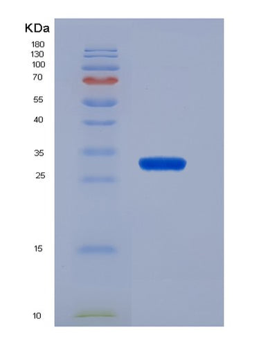 SDS-PAGE analysis of Mouse Klf4 (Krueppel-Like Factor 4) - Recombinant Protein, CAT# BLT-07616P, showing >90% purity under 15% SDS-PAGE (Reduced)Mouse Klf4 (Krueppel-Like Factor 4) - Recombinant Protein