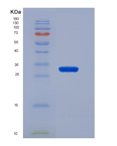 SDS-PAGE analysis of Mouse Klf4 (Krueppel-Like Factor 4) - Recombinant Protein, CATMouse Klf4 (Krueppel-Like Factor 4) - Recombinant Protein
