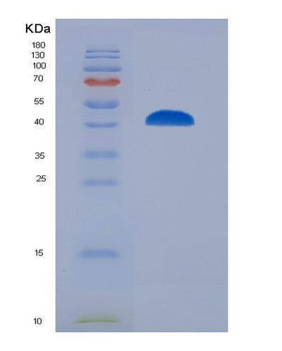 SDS-PAGE analysis of Human BCL6 (B-Cell Lymphoma 6 Protein) - Recombinant Protein, CAT# BLT-03073P, showing >95% purity under 15% SDS-PAGE (Reduced)Human BCL6 (B-Cell Lymphoma 6 Protein) - Recombinant Protein