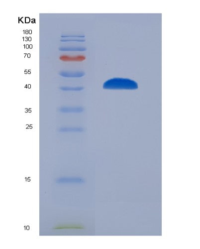 SDS-PAGE analysis of Human BCL6 (B-Cell Lymphoma 6 Protein) - Recombinant Protein, CATHuman BCL6 (B-Cell Lymphoma 6 Protein) - Recombinant Protein