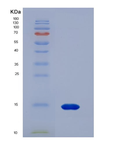 SDS-PAGE analysis of Human CASP2 (Caspase-2) - Recombinant Protein, CAT# BLT-00416P, showing >90% purity under 15% SDS-PAGE (Reduced)Human CASP2 (Caspase-2) - Recombinant Protein
