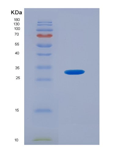 SDS-PAGE analysis of Human PDPK1 (3-Phosphoinositide-Dependent Protein Kinase 1) - Recombinant Protein, CATHuman PDPK1 (3-Phosphoinositide-Dependent Protein Kinase 1) - Recombinant Protein