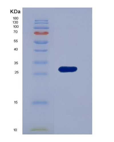 SDS-PAGE analysis of Human ADAM10 (Disintegrin And Metalloproteinase Domain-Containing Protein 10) - Recombinant Protein, CAT# BLT-07621P, showing >90% purity under 15% SDS-PAGE (Reduced)Human ADAM10 (Disintegrin And Metalloproteinase Domain-Containing Protein 10) - Recombinant Protein