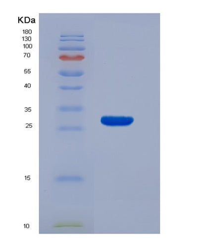 SDS-PAGE analysis of Human ADAM17 (Disintegrin And Metalloproteinase Domain-Containing Protein 17) - Recombinant Protein, CAT# BLT-07622P, showing >90% purity under 15% SDS-PAGE (Reduced)Human ADAM17 (Disintegrin And Metalloproteinase Domain-Containing Protein 17) - Recombinant Protein
