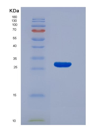 SDS-PAGE analysis of Human ADAM17 (Disintegrin And Metalloproteinase Domain-Containing Protein 17) - Recombinant Protein, CATHuman ADAM17 (Disintegrin And Metalloproteinase Domain-Containing Protein 17) - Recombinant Protein
