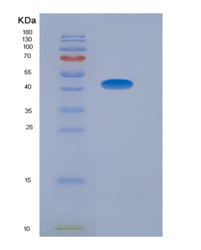 SDS-PAGE analysis of Human ADIPOR1 (Adiponectin Receptor Protein 1) - Recombinant Protein, CAT# BLT-07623P, showing >90% purity under 15% SDS-PAGE (Reduced)Human ADIPOR1 (Adiponectin Receptor Protein 1) - Recombinant Protein