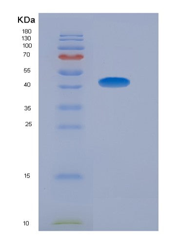 SDS-PAGE analysis of Human ADIPOR1 (Adiponectin Receptor Protein 1) - Recombinant Protein, CATHuman ADIPOR1 (Adiponectin Receptor Protein 1) - Recombinant Protein