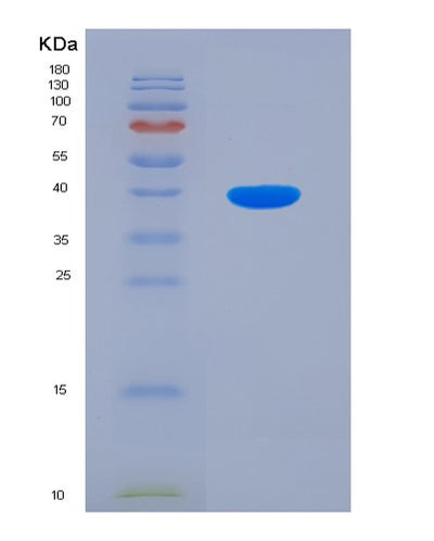 SDS-PAGE analysis of Mouse Adrb2 (Beta-2 Adrenergic Receptor) - Recombinant Protein, CAT# BLT-07625P, showing >90% purity under 15% SDS-PAGE (Reduced)Mouse Adrb2 (Beta-2 Adrenergic Receptor) - Recombinant Protein