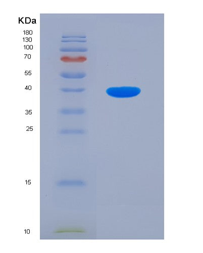 SDS-PAGE analysis of Mouse Adrb2 (Beta-2 Adrenergic Receptor) - Recombinant Protein, CATMouse Adrb2 (Beta-2 Adrenergic Receptor) - Recombinant Protein