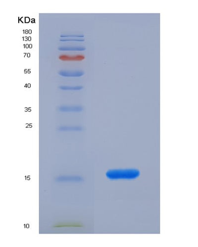 SDS-PAGE analysis of Mouse Lipe (Hormone-Sensitive Lipase) - Recombinant Protein, CAT# BLT-07626P, showing >90% purity under 15% SDS-PAGE (Reduced)Mouse Lipe (Hormone-Sensitive Lipase) - Recombinant Protein