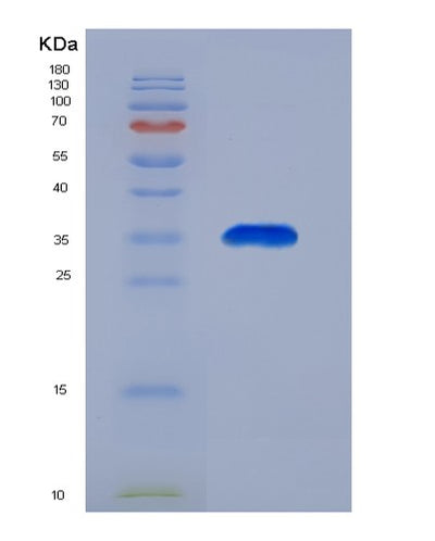 SDS-PAGE analysis of Human ACAA2 (3-Ketoacyl-Coa Thiolase, Mitochondrial) - Recombinant Protein, CAT# BLT-00023P, showing >90% purity under 15% SDS-PAGE (Reduced)Human ACAA2 (3-Ketoacyl-Coa Thiolase, Mitochondrial) - Recombinant Protein