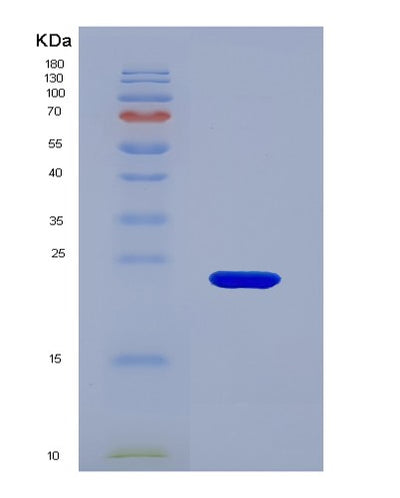 SDS-PAGE analysis of Human ALDH1A3 (Retinaldehyde Dehydrogenase 3) - Recombinant Protein, CAT# BLT-05730P, showing >90% purity under 15% SDS-PAGE (Reduced)Human ALDH1A3 (Retinaldehyde Dehydrogenase 3) - Recombinant Protein