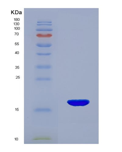 SDS-PAGE analysis of Mouse Rnase2 (Non-Secretory Ribonuclease) - Recombinant Protein, CAT# BLT-07628P, showing >90% purity under 15% SDS-PAGE (Reduced)Mouse Rnase2 (Non-Secretory Ribonuclease) - Recombinant Protein