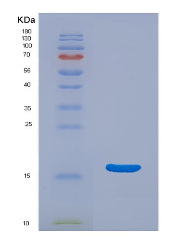 SDS-PAGE analysis of Mouse Ear3 (Eosinophil Cationic-Type Ribonuclease 3) - Recombinant Protein, CAT# BLT-07629P, showing >90% purity under 15% SDS-PAGE (Reduced)Mouse Ear3 (Eosinophil Cationic-Type Ribonuclease 3) - Recombinant Protein