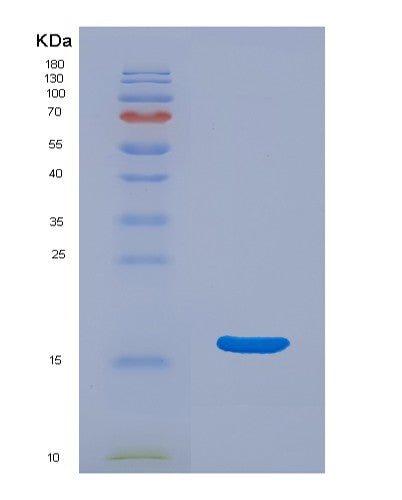 SDS-PAGE analysis of Mouse Ear3 (Eosinophil Cationic-Type Ribonuclease 3) - Recombinant Protein, CATMouse Ear3 (Eosinophil Cationic-Type Ribonuclease 3) - Recombinant Protein