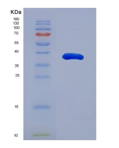 SDS-PAGE analysis of Mouse Aldh1a1 (Aldehyde Dehydrogenase 1A1) - Recombinant Protein, CAT# BLT-07631P, showing >90% purity under 15% SDS-PAGE (Reduced)Mouse Aldh1a1 (Aldehyde Dehydrogenase 1A1) - Recombinant Protein