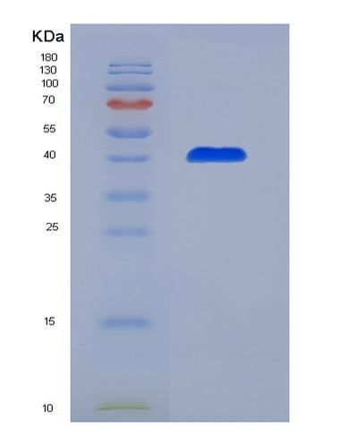 SDS-PAGE analysis of Mouse Vtn (Vitronectin) - Recombinant Protein, CAT# BLT-07632P, showing >90% purity under 15% SDS-PAGE (Reduced)Mouse Vtn (Vitronectin) - Recombinant Protein
