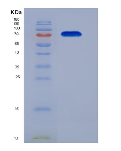 SDS-PAGE analysis of Human TRAP1 (Heat Shock Protein 75 Kda, Mitochondrial) - Recombinant Protein, CAT# BLT-07635P, showing >90% purity under 15% SDS-PAGE (Reduced)Human TRAP1 (Heat Shock Protein 75 Kda, Mitochondrial) - Recombinant Protein