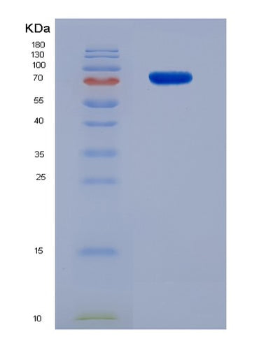 SDS-PAGE analysis of Human HSP90AB1 (Heat Shock Protein Hsp 90-Beta) - Recombinant Protein, CAT# BLT-07636P, showing >90% purity under 15% SDS-PAGE (Reduced)Human HSP90AB1 (Heat Shock Protein Hsp 90-Beta) - Recombinant Protein