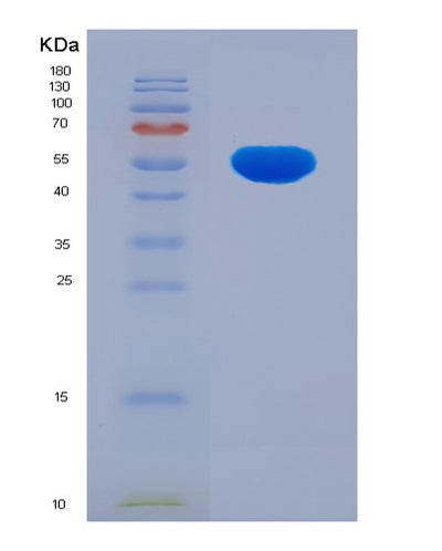 SDS-PAGE analysis of Human ALDH1B1 (Aldehyde Dehydrogenase X, Mitochondrial) - Recombinant Protein, CAT# BLT-07639P, showing >90% purity under 15% SDS-PAGE (Reduced)Human ALDH1B1 (Aldehyde Dehydrogenase X, Mitochondrial) - Recombinant Protein