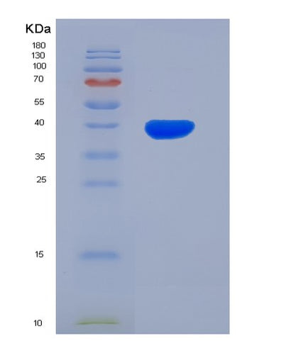 SDS-PAGE analysis of Human FGL1 (Fibrinogen-Like Protein 1) - Recombinant Protein, CAT# BLT-07640P, showing >90% purity under 15% SDS-PAGE (Reduced)Human FGL1 (Fibrinogen-Like Protein 1) - Recombinant Protein