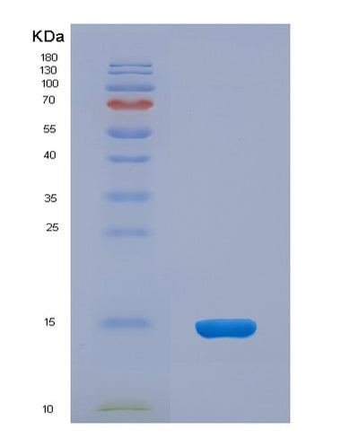 SDS-PAGE analysis of Mouse Ccn2 (Ccn Family Member 2) - Recombinant Protein, CAT# BLT-07641P, showing >90% purity under 15% SDS-PAGE (Reduced)Mouse Ccn2 (Ccn Family Member 2) - Recombinant Protein