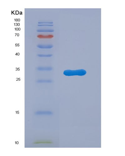 SDS-PAGE analysis of Mouse Ctss (Cathepsin S) - Recombinant Protein, CAT# BLT-07642P, showing >90% purity under 15% SDS-PAGE (Reduced)Mouse Ctss (Cathepsin S) - Recombinant Protein