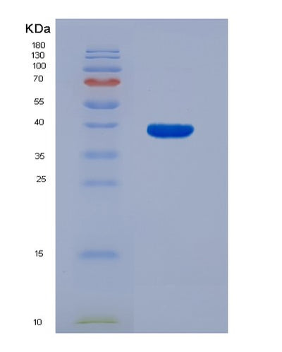 SDS-PAGE analysis of Human FARSB (Phenylalanine--Trna Ligase Beta Subunit) - Recombinant Protein, CAT# BLT-07643P, showing >90% purity under 15% SDS-PAGE (Reduced)Human FARSB (Phenylalanine--Trna Ligase Beta Subunit) - Recombinant Protein