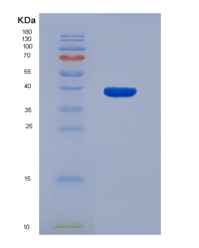 SDS-PAGE analysis of Human FARSB (Phenylalanine--Trna Ligase Beta Subunit) - Recombinant Protein, CATHuman FARSB (Phenylalanine--Trna Ligase Beta Subunit) - Recombinant Protein