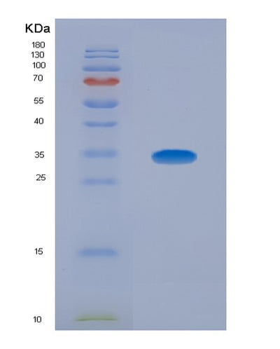 SDS-PAGE analysis of Human FARSA (Phenylalanine--Trna Ligase Alpha Subunit) - Recombinant Protein, CAT# BLT-07644P, showing >90% purity under 15% SDS-PAGE (Reduced)Human FARSA (Phenylalanine--Trna Ligase Alpha Subunit) - Recombinant Protein