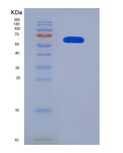 SDS-PAGE analysis of Human IARS1 (Isoleucine--Trna Ligase, Cytoplasmic) - Recombinant Protein, CAT# BLT-07646P, showing >90% purity under 15% SDS-PAGE (Reduced)Human IARS1 (Isoleucine--Trna Ligase, Cytoplasmic) - Recombinant Protein