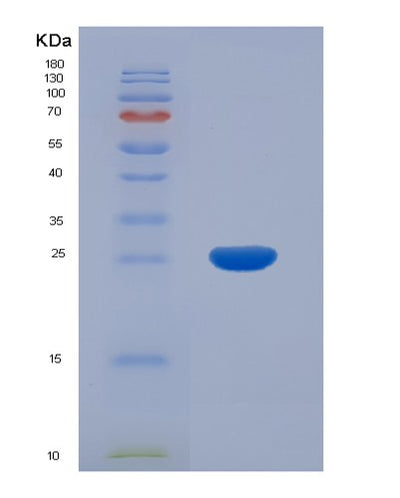 SDS-PAGE analysis of Human KIR2DL1 (Killer Cell Immunoglobulin-Like Receptor 2Dl1) - Recombinant Protein, CAT# BLT-01626P, showing >90% purity under 15% SDS-PAGE (Reduced)Human KIR2DL1 (Killer Cell Immunoglobulin-Like Receptor 2Dl1) - Recombinant Protein