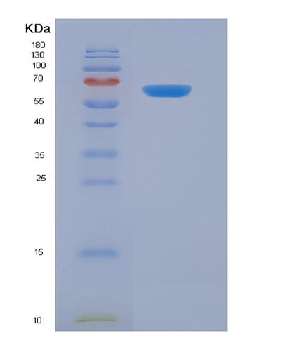 SDS-PAGE analysis of Human KIR3DL1 (Killer Cell Immunoglobulin-Like Receptor 3Dl1) - Recombinant Protein, CAT# BLT-01629P, showing >90% purity under 15% SDS-PAGE (Reduced)Human KIR3DL1 (Killer Cell Immunoglobulin-Like Receptor 3Dl1) - Recombinant Protein