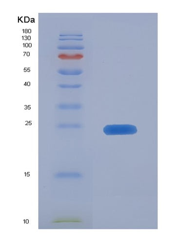 SDS-PAGE analysis of Human MMP13 (Collagenase 3) - Recombinant Protein, CAT# BLT-01873P, showing >90% purity under 15% SDS-PAGE (Reduced)Human MMP13 (Collagenase 3) - Recombinant Protein