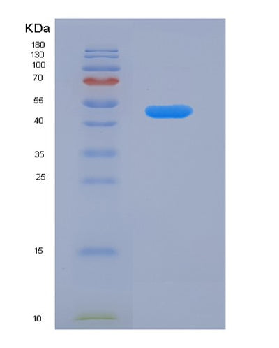 SDS-PAGE analysis of Human ACADSB (Short/Branched Chain Specific Acyl-Coa Dehydrogenase, Mitochondrial) - Recombinant Protein, CAT# BLT-00028P, showing >95% purity under 15% SDS-PAGE (Reduced)Human ACADSB (Short/Branched Chain Specific Acyl-Coa Dehydrogenase, Mitochondrial) - Recombinant Protein