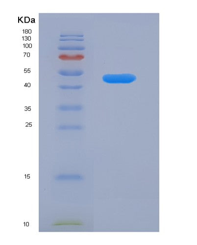 SDS-PAGE analysis of Human ACADSB (Short/Branched Chain Specific Acyl-Coa Dehydrogenase, Mitochondrial) - Recombinant Protein, CATHuman ACADSB (Short/Branched Chain Specific Acyl-Coa Dehydrogenase, Mitochondrial) - Recombinant Protein