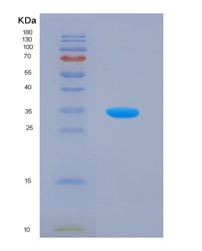 SDS-PAGE analysis of Human MAPK9 (Mitogen-Activated Protein Kinase 9) - Recombinant Protein, CATHuman MAPK9 (Mitogen-Activated Protein Kinase 9) - Recombinant Protein