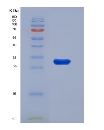 SDS-PAGE analysis of Mouse Fst (Follistatin) - Recombinant Protein, CAT# BLT-05680P, showing >95% purity under 15% SDS-PAGE (Reduced)Mouse Fst (Follistatin) - Recombinant Protein