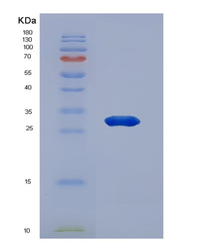 SDS-PAGE analysis of Human CDKN1B (Cyclin-Dependent Kinase Inhibitor 1B) - Recombinant Protein, CAT# BLT-04590P, showing >95% purity under 15% SDS-PAGE (Reduced)Human CDKN1B (Cyclin-Dependent Kinase Inhibitor 1B) - Recombinant Protein