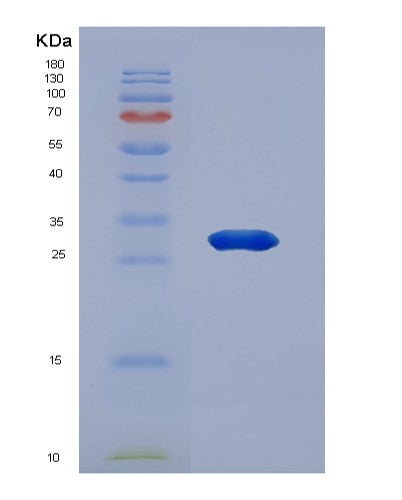 SDS-PAGE analysis of Human CDKN1B (Cyclin-Dependent Kinase Inhibitor 1B) - Recombinant Protein, CATHuman CDKN1B (Cyclin-Dependent Kinase Inhibitor 1B) - Recombinant Protein