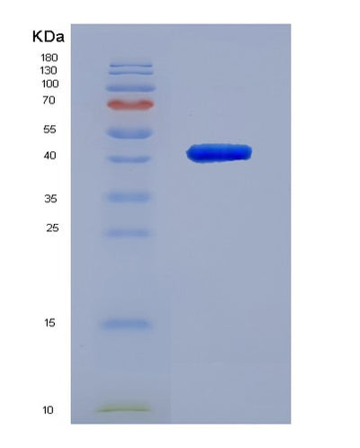 SDS-PAGE analysis of Human ACTB (Actin, Cytoplasmic 1) - Recombinant Protein, CAT# BLT-07647P, showing >90% purity under 15% SDS-PAGE (Reduced)Human ACTB (Actin, Cytoplasmic 1) - Recombinant Protein